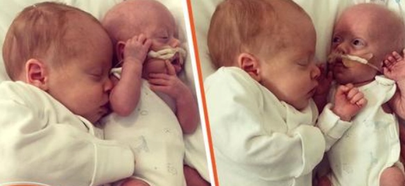 Baby wurde zu früh geboren, kämpft aber dank Kuscheln von seinem Zwillingsbruder weiter